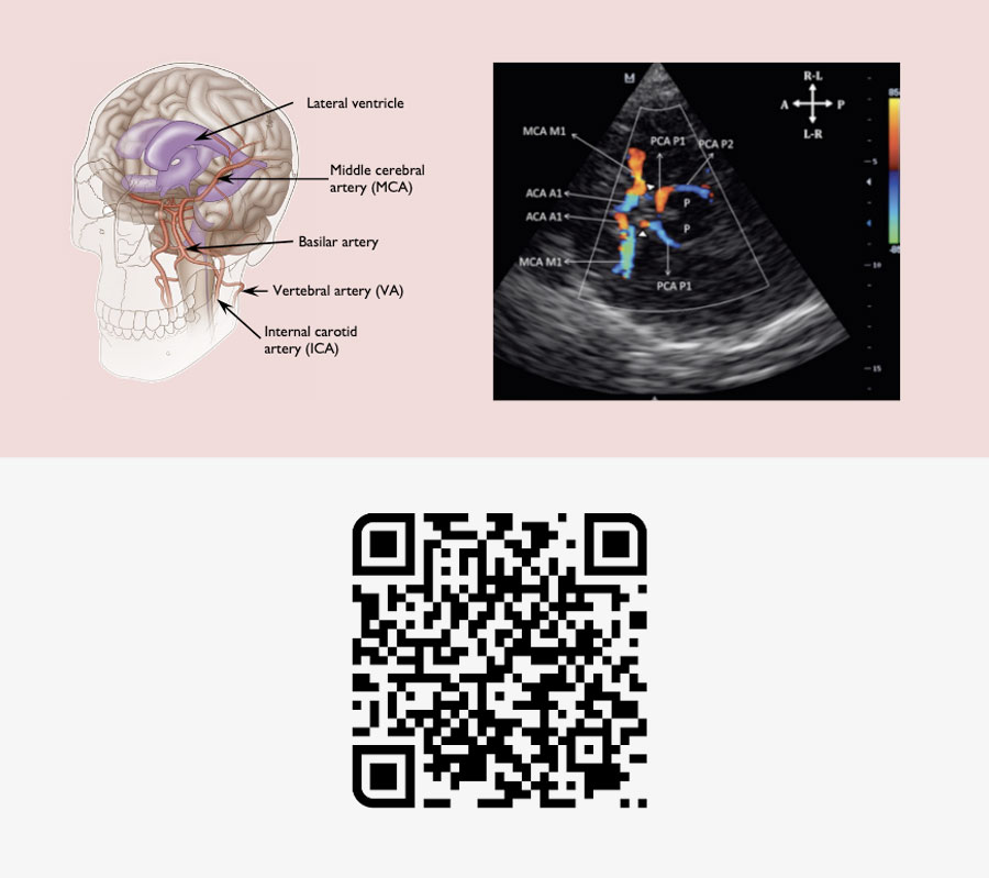 Interested in brain monitoring?