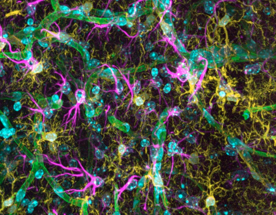 Neural activity