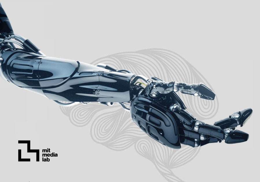 Upper limb amputees advanced prosthesis study