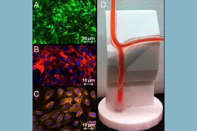 Tissue engineered coronary artery