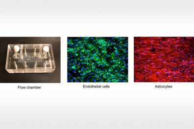 Blood brain barrier